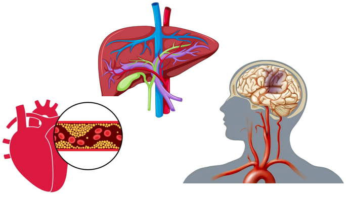 肝与心脏血管疾病.png