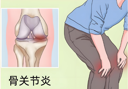 冬病夏治.png