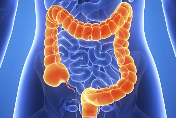 菊苣与结肠炎.png 菊苣与结肠炎.png