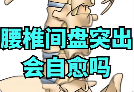 腰椎间盘突出吃什么效果好.png 腰椎间盘突出吃什么效果好.png