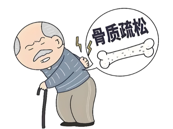 骨质疏松.png